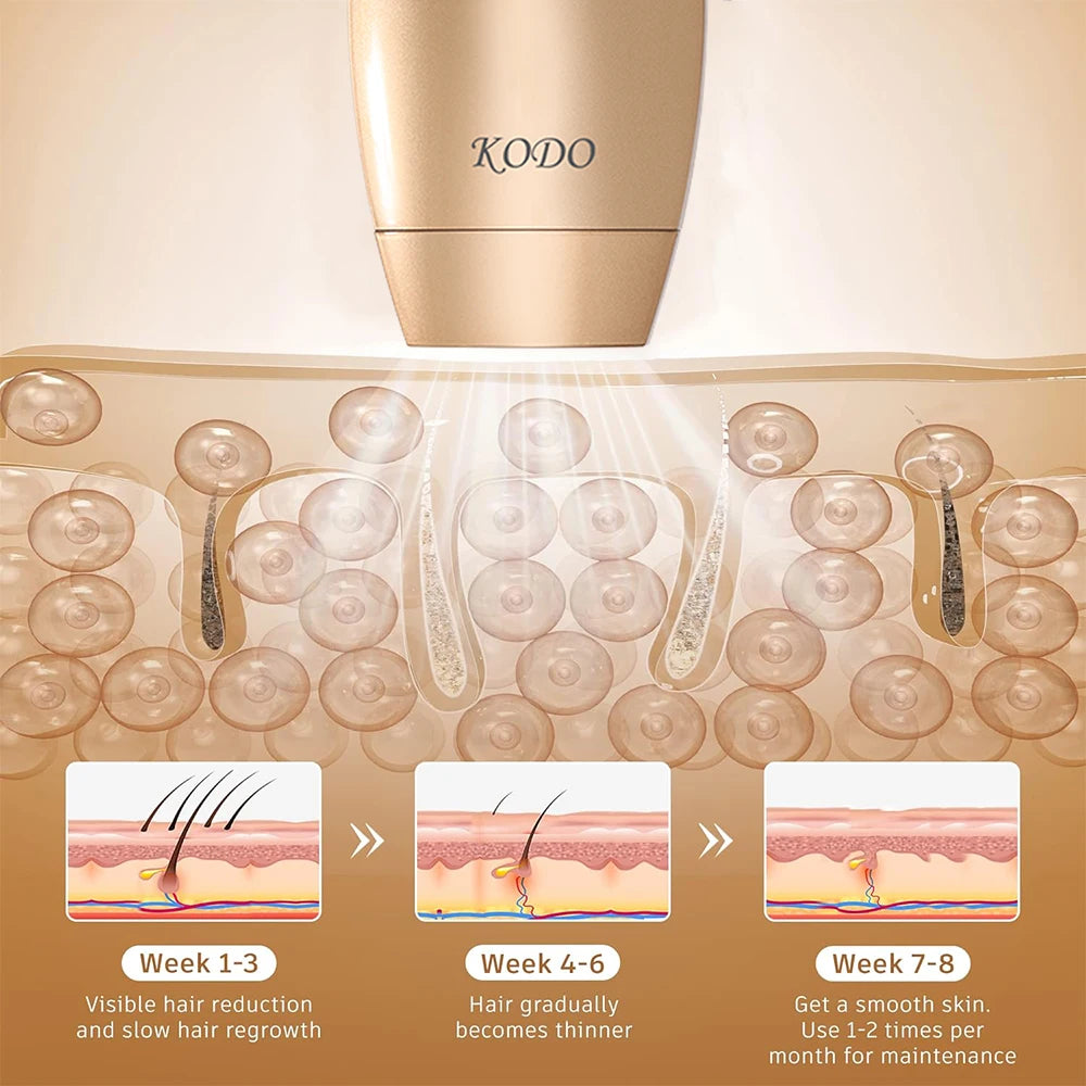High-Quality Customizable Ice Laser Hair Remover