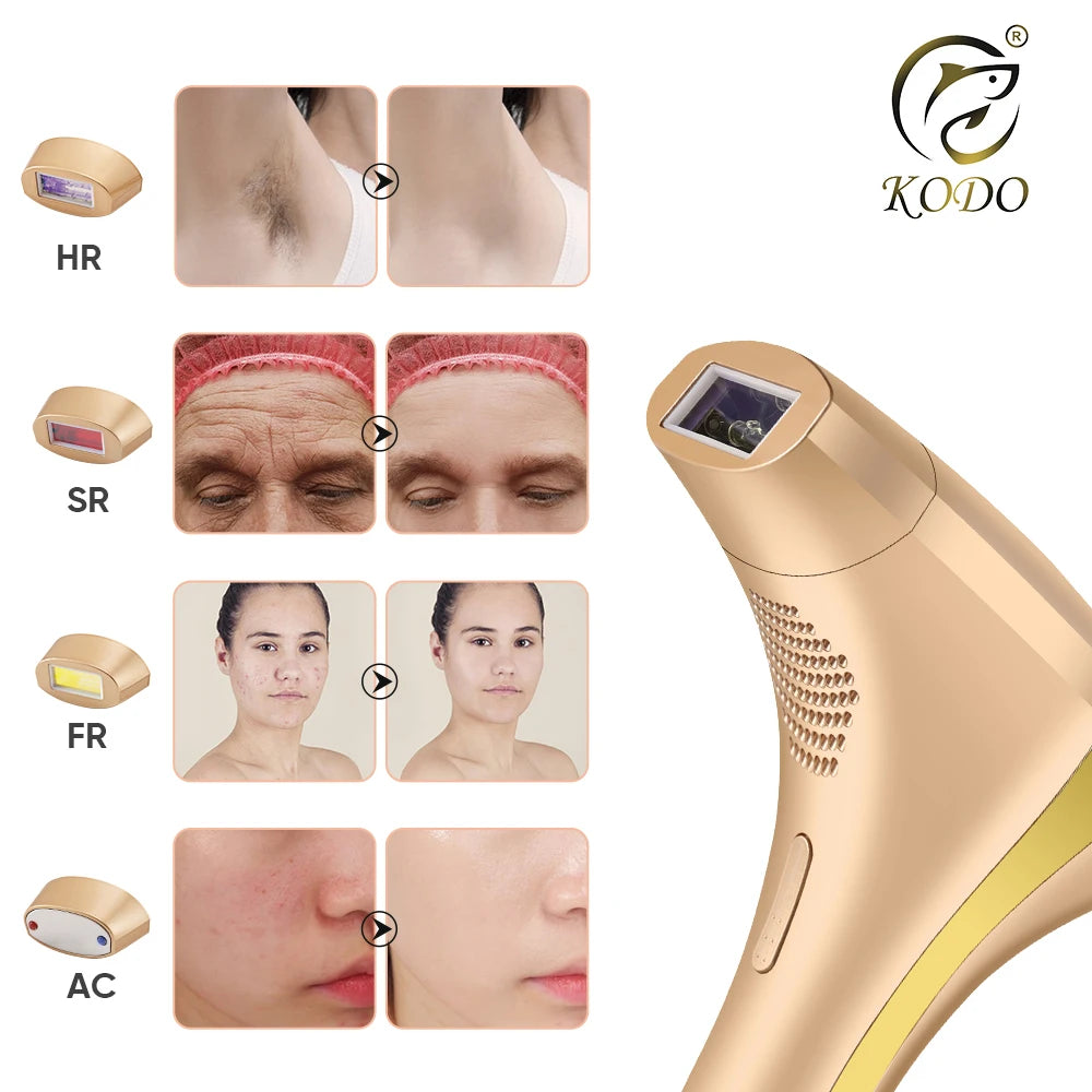 High-Quality Customizable Ice Laser Hair Remover